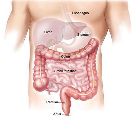 laparoscopic